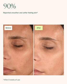 Toning Pads